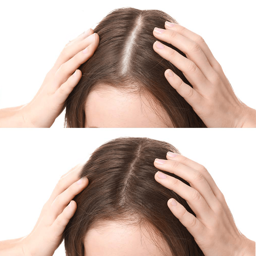 Rootroxy™ FEG plus Hair Growth Spray